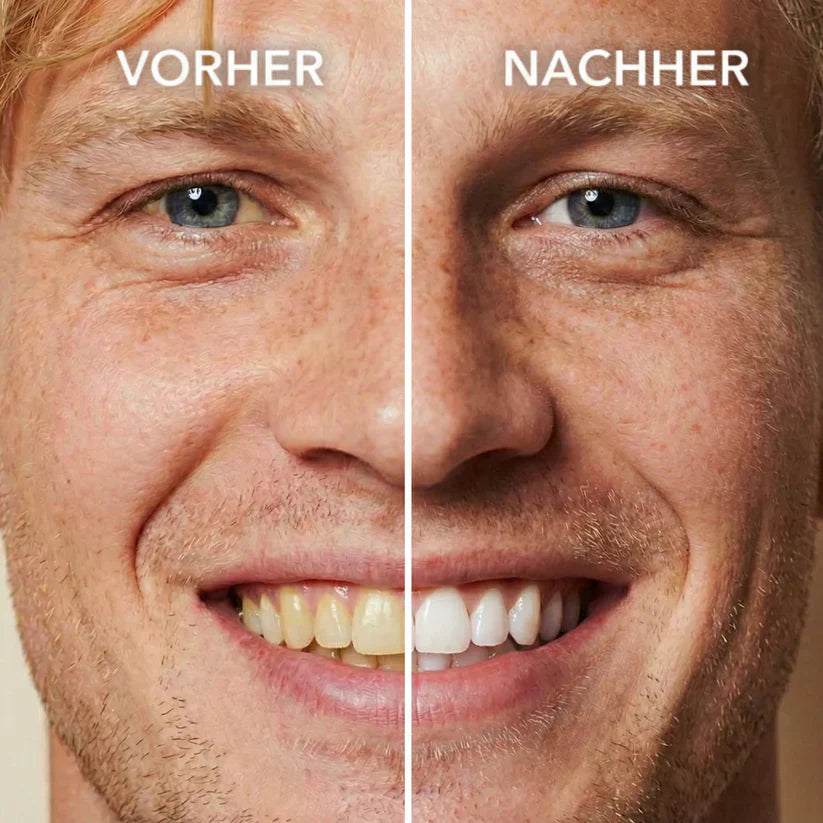 Tooth Polish - Instant Clean Smile