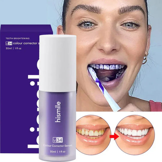 HISMILE - TEETH WHITENING - 2x1