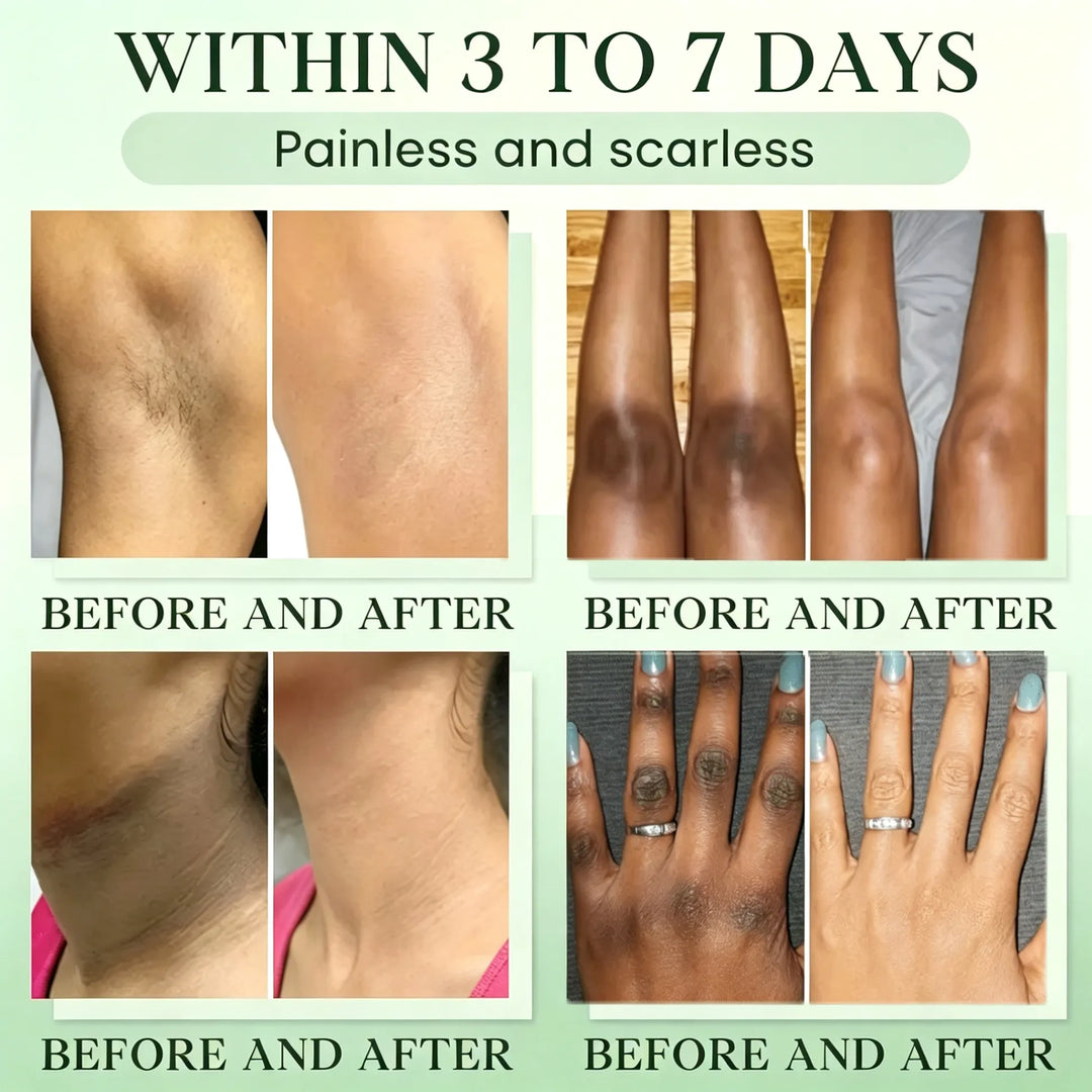 Green Tea Triple Enzyme Peeling Gel for Dark &amp; Intimate Areas