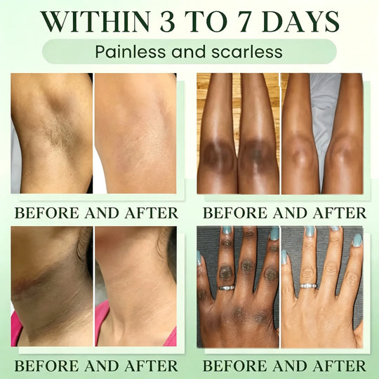 Green Tea Triple Enzyme Peeling Gel for Dark &amp; Intimate Areas