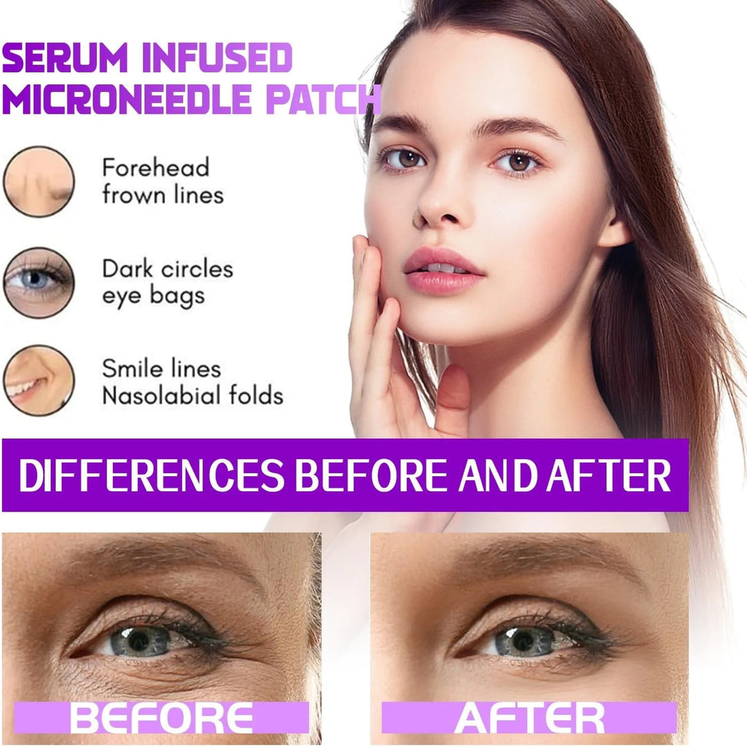 Eye Patches——TARGETS EYE BAGS &amp; DARK CIRCLES