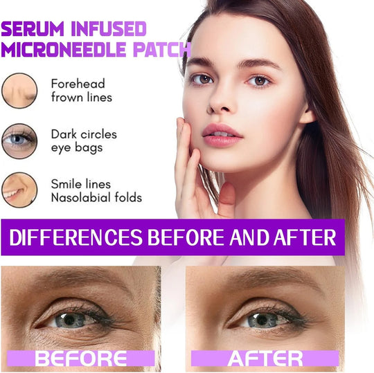 Eye Patches——TARGETS EYE BAGS &amp; DARK CIRCLES