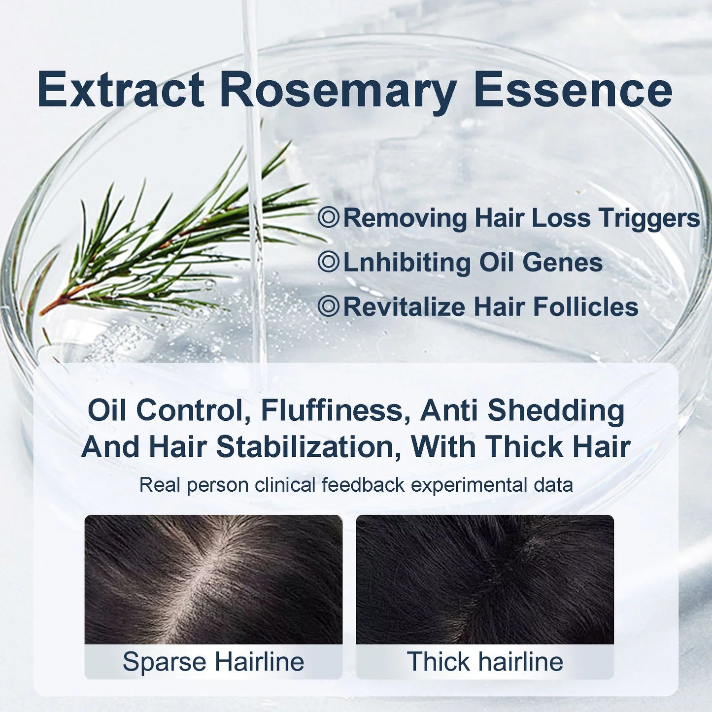 💥Grote inhoud van 450 ml💥Tgideas Rozemarijn Shampoo