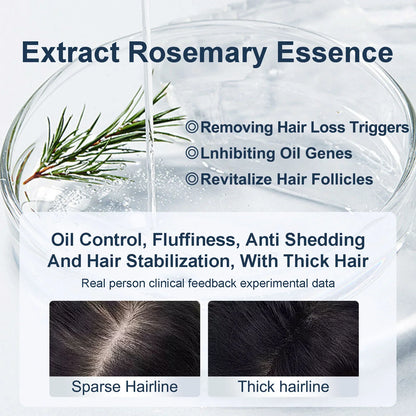 💥Grote inhoud van 450 ml💥Tgideas Rozemarijn Shampoo