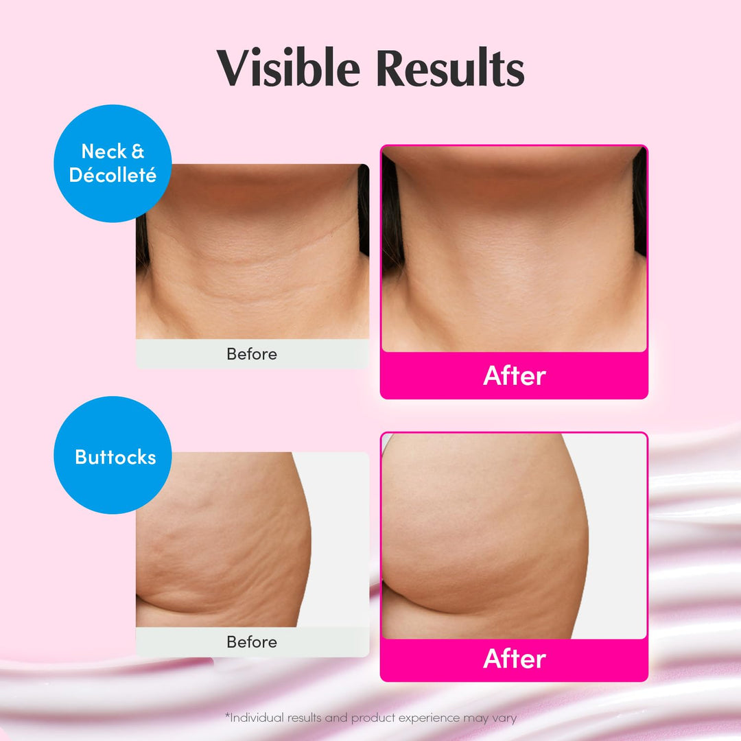 Firming &amp; Lifting Pink Neck Cream for Sagging Skin