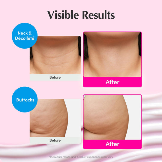 Firming &amp; Lifting Pink Neck Cream for Sagging Skin