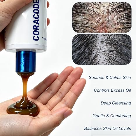 Folliculitis Shampoo for Itchy, Flaky Scalp - Purifying Formula for a Soothed, Balanced Scalp &amp; Oily Scalp Care, Men &amp; Women, 10.58 Fl Oz