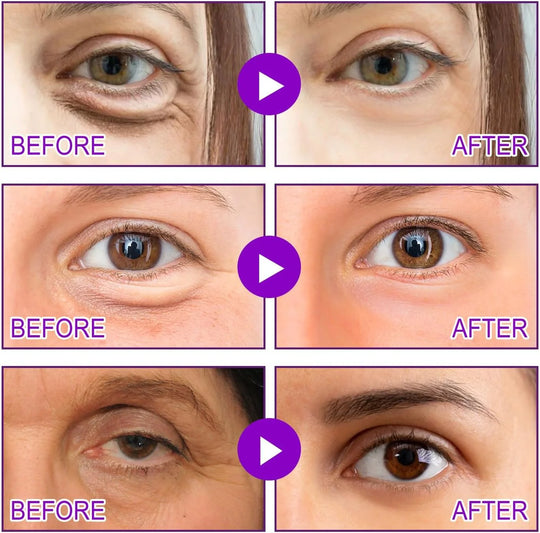 Eye Patches——TARGETS EYE BAGS &amp; DARK CIRCLES