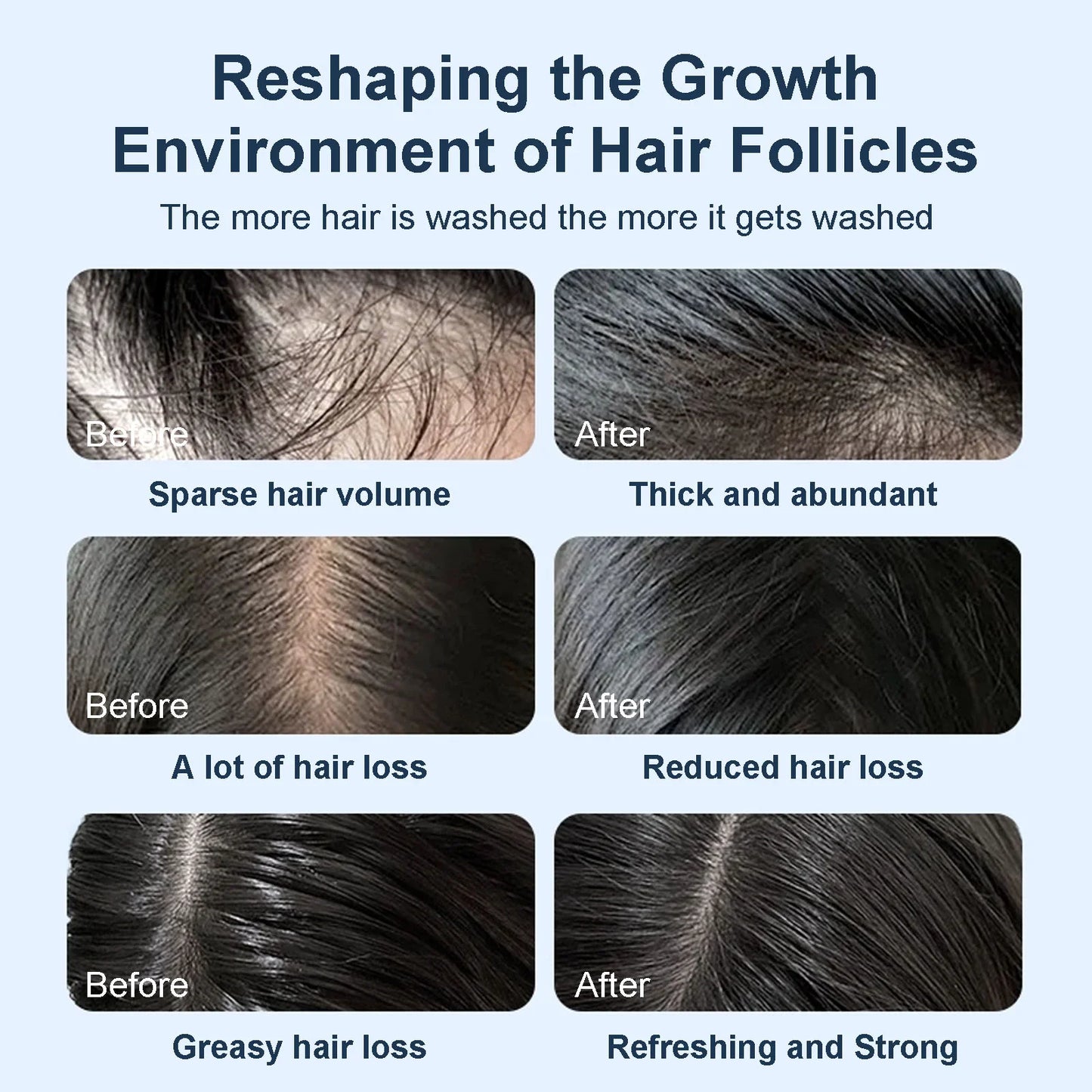 💥Grote inhoud van 450 ml💥Tgideas Rozemarijn Shampoo