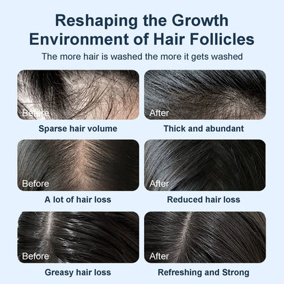 💥Grote inhoud van 450 ml💥Tgideas Rozemarijn Shampoo