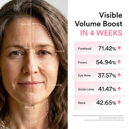 [NEW] Abib PDRN Volume fill-it Booster Cream | For Forehead, Eye Area, Smile Lines &amp; Neck Wrinkles | Anti-Aging Firming