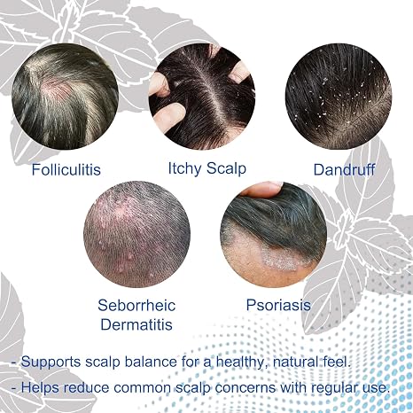 Folliculitis Shampoo for Itchy, Flaky Scalp - Purifying Formula for a Soothed, Balanced Scalp &amp; Oily Scalp Care, Men &amp; Women, 10.58 Fl Oz