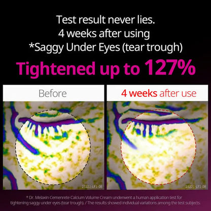 Dr.Melaxin Officiel | Kalciumkoncentreret reparationscreme