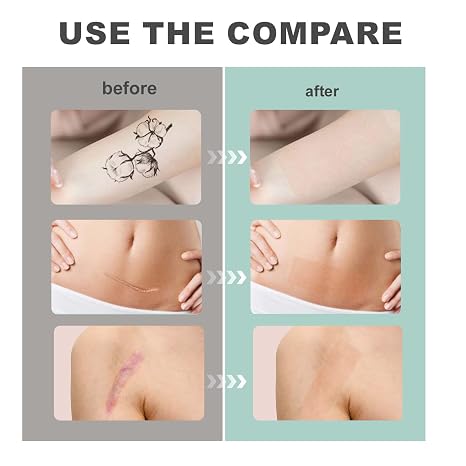 Silicone Collagen Sheets