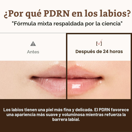 Dr. Reju-All Advanced PDRN - Rejuvenating Lip Serum - Moisturizing Lip Balm with Lipozip PDRN for Glossy, Dewy Lips - Gentle Exfoliating &amp; Smoothing Lip Moisturizer - Hibiscus &amp; Lactic Acid