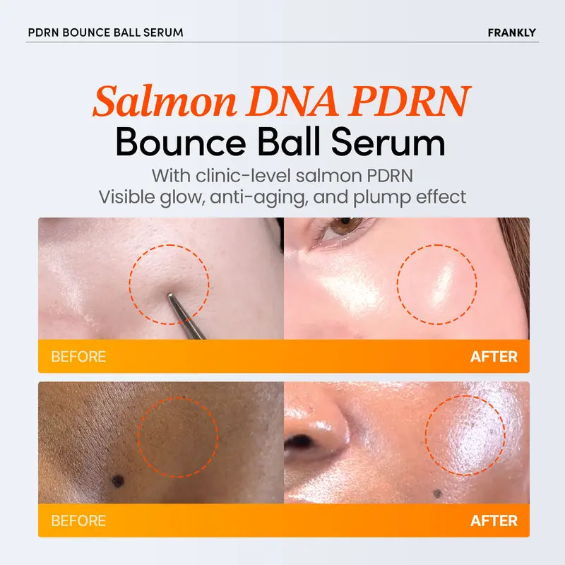 [FRANKLY] PDRN Bounce Ball Serum | 99% Pure Salmon DNA Moisturizer for Skin Repair &amp; Glow Skin | Barrier Repair, Glow Skin, Plumping Effect, Korean Skincare, Lightweight