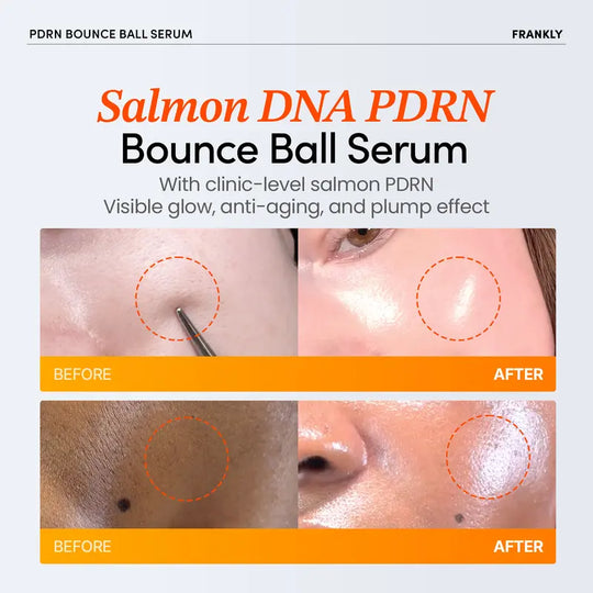 [FRANKLY] PDRN Bounce Ball Serum | 99% Pure Salmon DNA Moisturizer for Skin Repair &amp; Glow Skin | Barrier Repair, Glow Skin, Plumping Effect, Korean Skincare, Lightweight