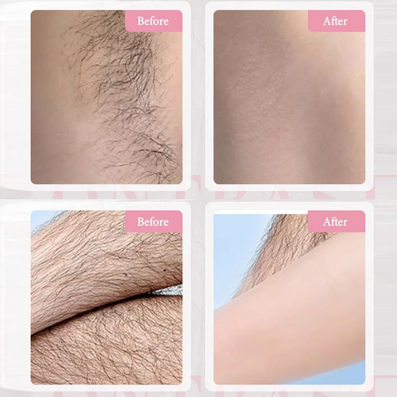 🎉Spring Hot Sale🎉Gentle &amp; Effective Hair Removal Cream