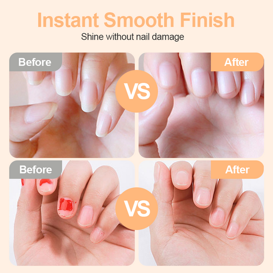 🌟 2‑w‑1 Inteligentny elektryczny obcinacz i polerka do paznokci ✂️💅