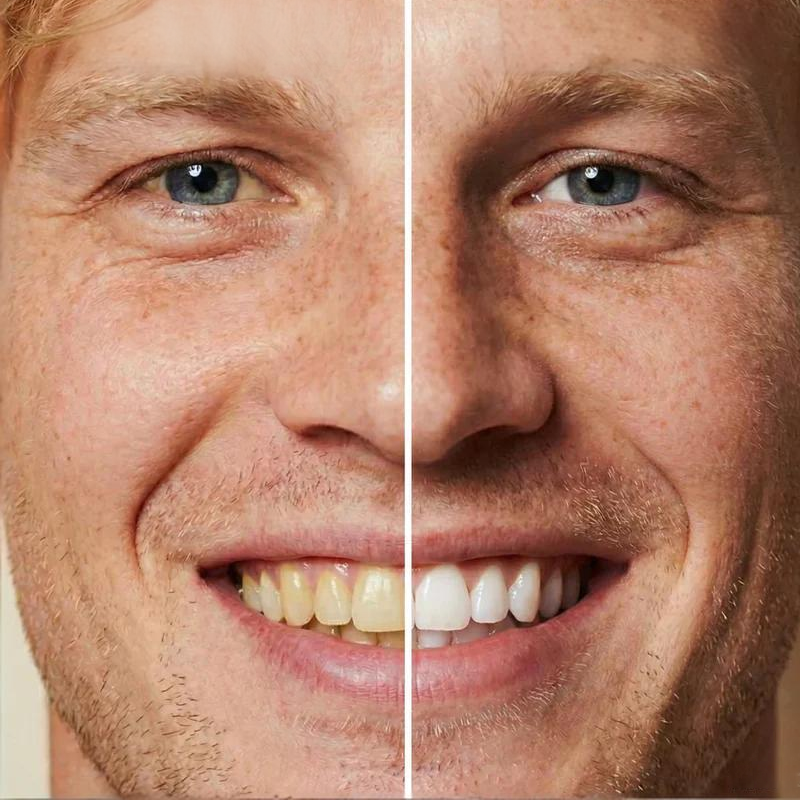 🏆Nye varer i 2026 - 50% rabat!🧴Øjeblikkelig tandblegning