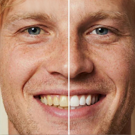 🏆2026 New Arrivals - 50% Off!🧴Instant Whitening Tooth Paint
