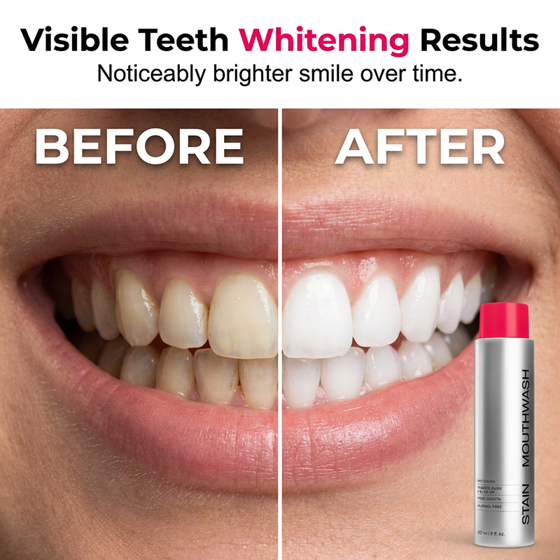🔥2026 SALE -Advanced Stain-Lifting Whitening Mouthwash: Visible Debris Removal & Fresh Breath